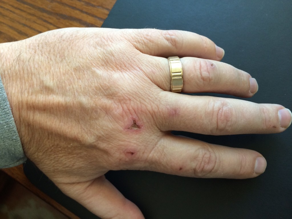 One of ,my hands after demolition to the kitchen and bathrooms